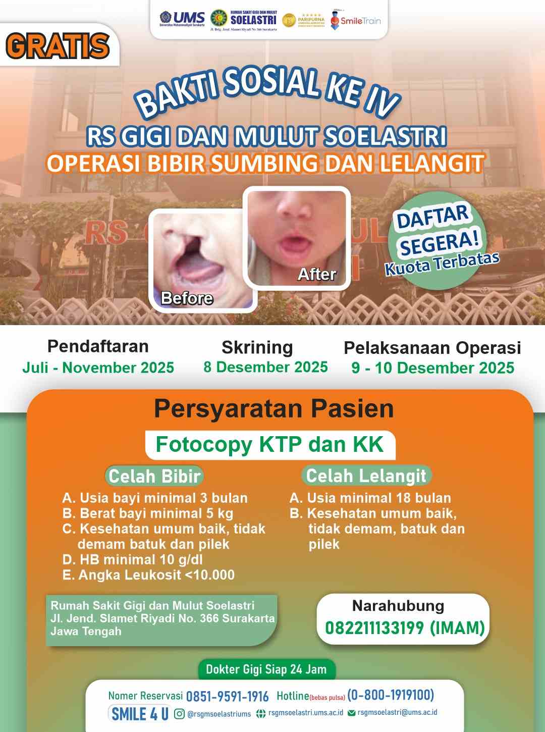 Read more about the article BAKTI SOSIAL OPERASI BIBIR SUMBING DAN LELANGIT