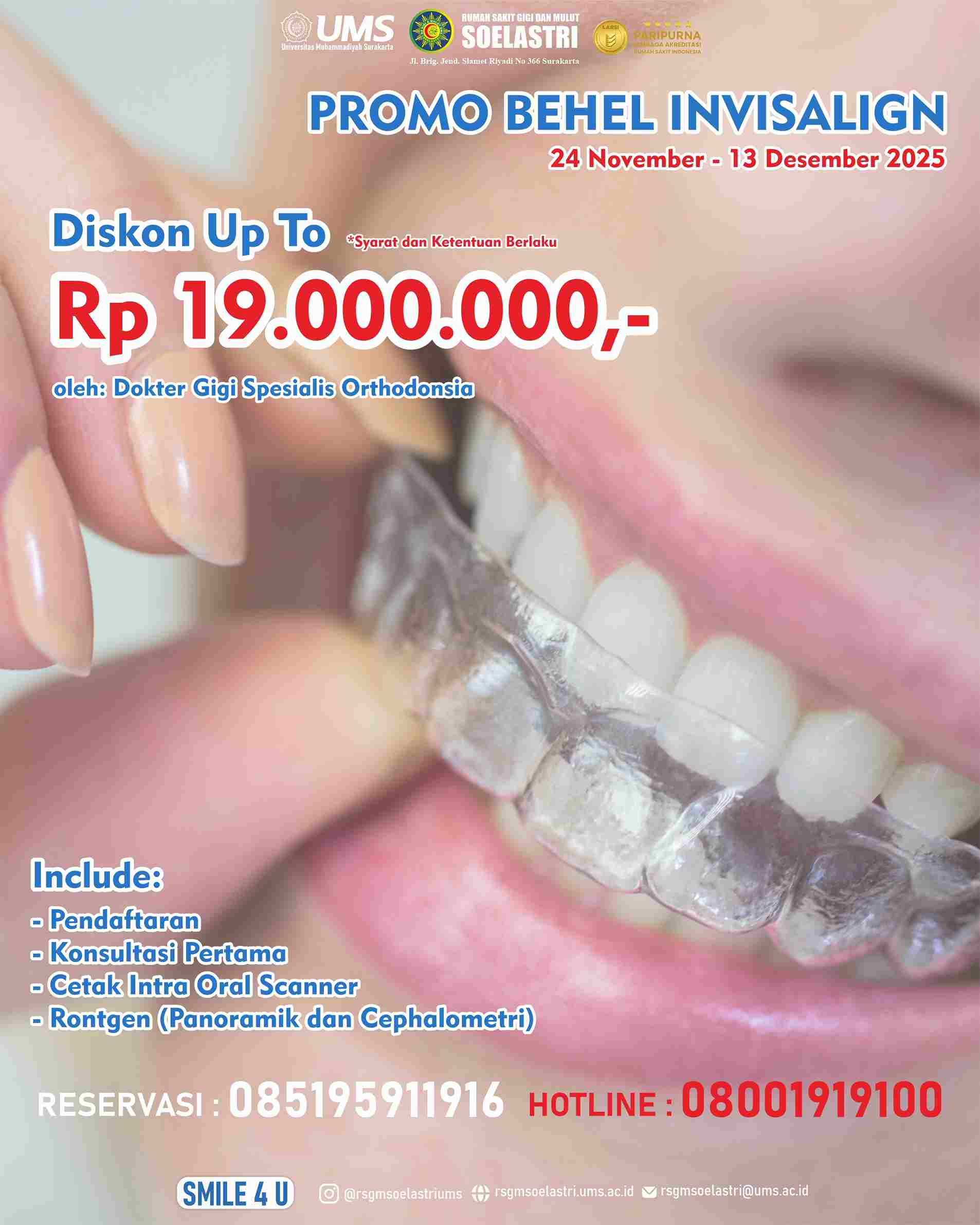 Read more about the article Behel Invisalign DISKON UP TO Rp 19.000.000,-