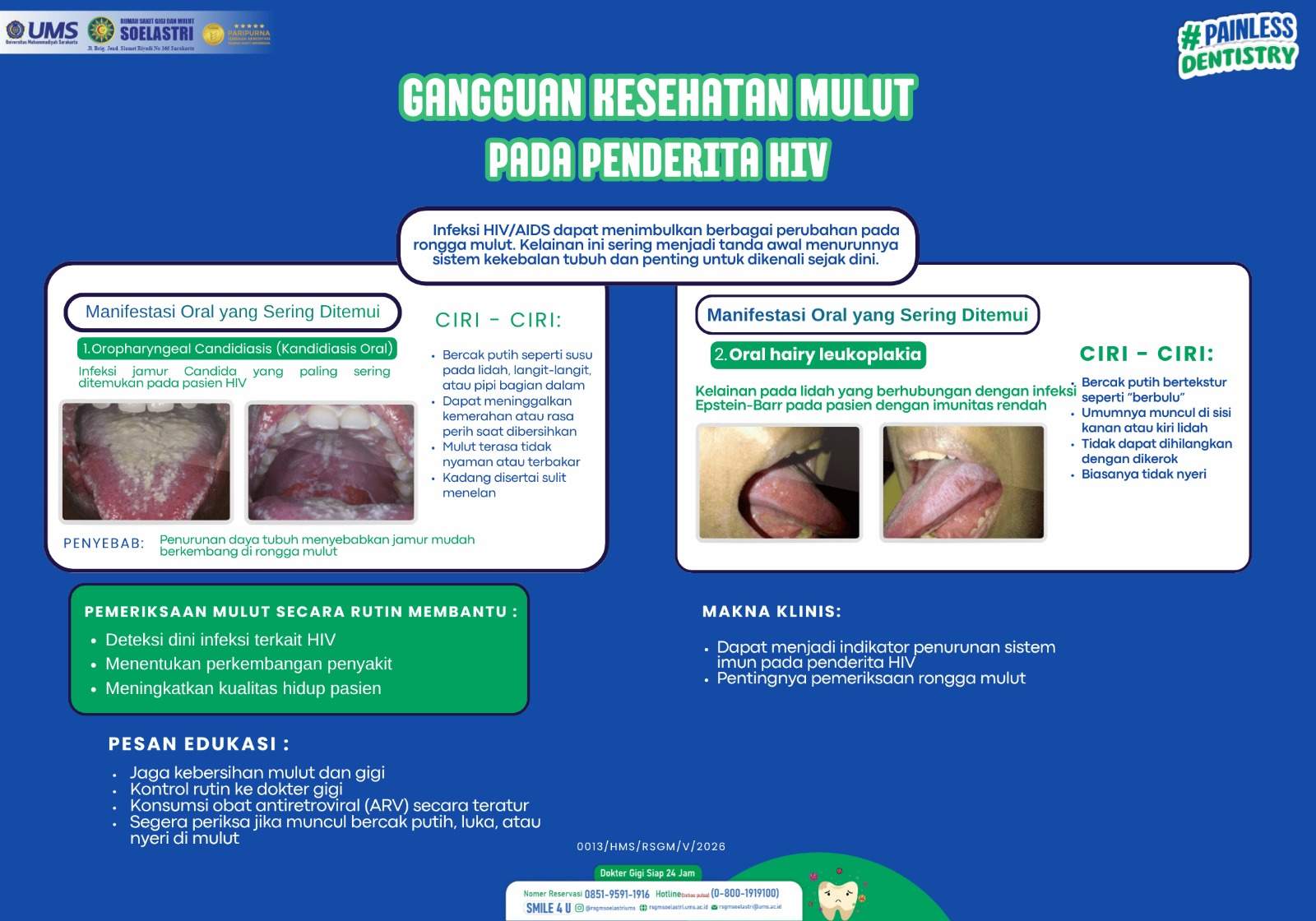 You are currently viewing Gangguan Kesehatan Mulut Pada Penderita HIV